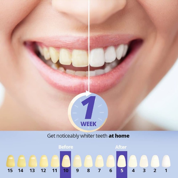 Ualans dientes blancos